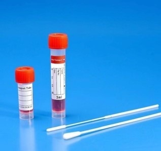 150mm si è affollato il tampone nasale per il virus che prova Kit Specimen Collection Of Covid-19