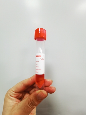 Metropolitana di trasporto del tampone dell'esemplare dello spiritello malevolo 10ml con la soluzione 3ml