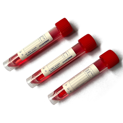 Metropolitana di trasporto del tampone dell'esemplare dello spiritello malevolo 10ml con la soluzione 3ml