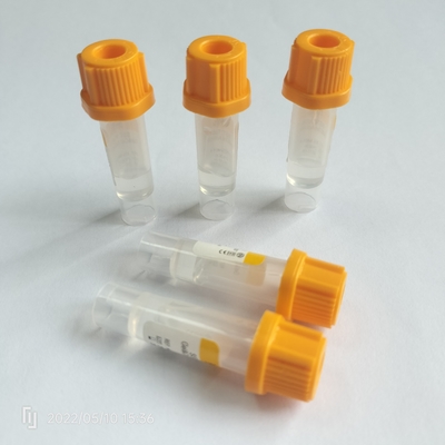del bambino 0.25ml-1ml tubi di Vacuum del gel della metropolitana della raccolta del sangue di vuoto non