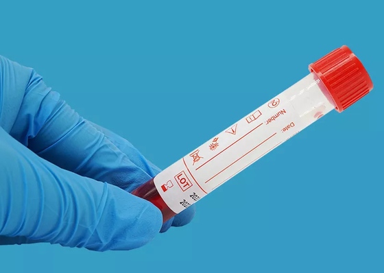 Virus eliminabile 10ml che prova Kit Nucleic Acid Extraction Kit