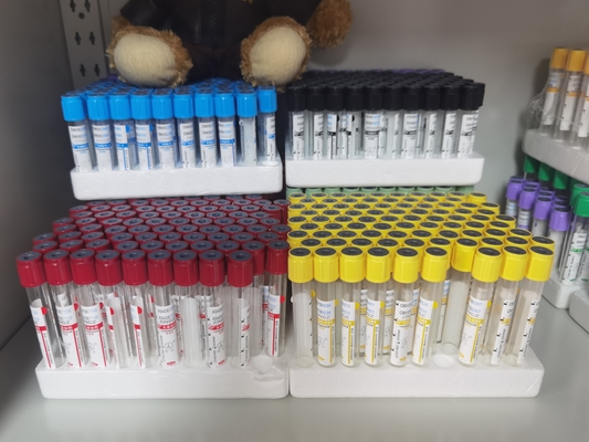 Tubo di citrato di sodio medico essenziale per la ricerca di laboratorio